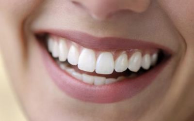 Comment garder les dents blanches naturellement ?