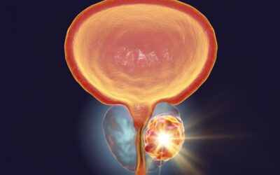 Cancer de la prostate : quels sont les facteurs à risque ?
