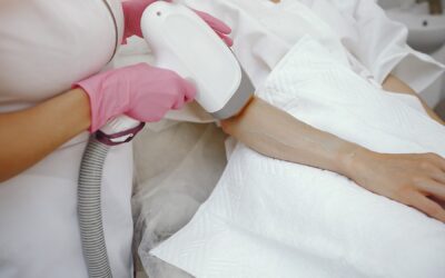 Épilation laser : entre précision et sensations